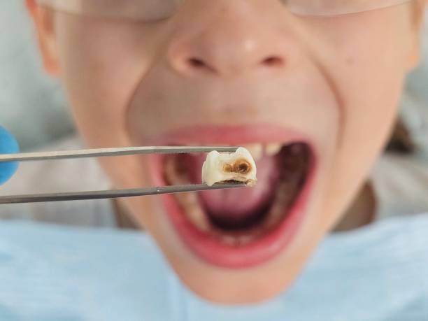 Best Emergency Pediatric Dentist  in Sedro Woolley, WA